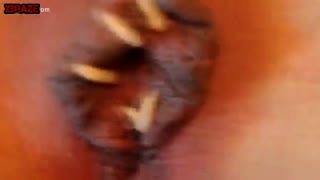 Woman pussy fuck crawling worms, maggots and other creepy creatures